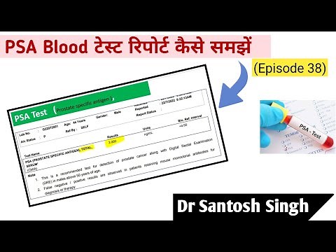 How To Read PSA Test Report? Prostate Cancer | Dr Santosh Singh (Episode 38)
