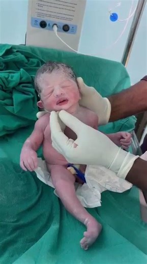 Newborn First Checkup After Delivery | Doctor’s Complete Process #nicubaby143 #babyhealth