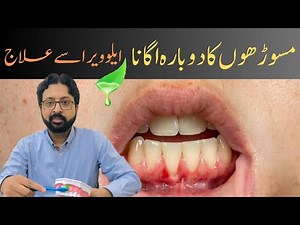 How to Rebuild Receding Gums Naturally with Aloe Vera