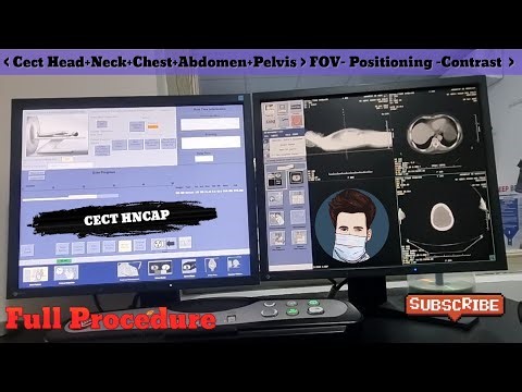 CECT HNCAP | Full Procedure | By Anis Qureshi 