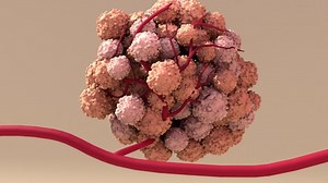 Tumor Abnormal Mass Tissue That Forms Stock Footage Video (100% Royalty-free) 1076381147 | Shutterstock