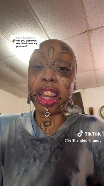 Understanding Overbite and Mouth Closure