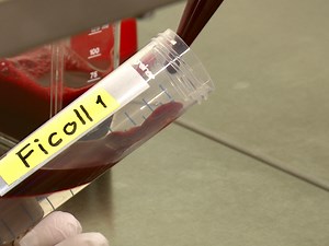 Isolation and Ex Vivo Culture of Vδ1+CD4+γδ T Cells, an Extrathymic αβT-cell Progenitor