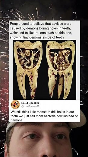 Medieval Tooth Demons Vs Modern Cavity Monsters