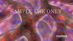 4.4K views · 96 reactions | Bronchoscopy | Learning Medicine | Facebook