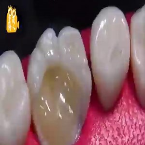 46K views · 329 reactions | Dahil para kumagat ng buto, mag deep fillings, napakakomplikado ng proseso pero sobrang komportable ang panonood hanggang dulo | Sweet Love | Facebook