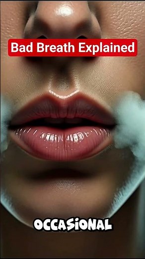 Halitosis Explained: The Reason Your Breath Smells #BadBreath #MouthOdor