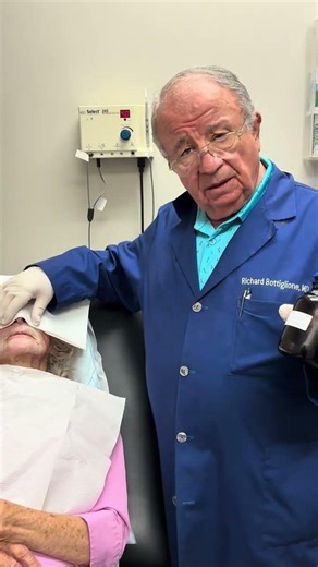 Dr. B shows using TCA 50% around mouth (part 5) #tca50 #frosting