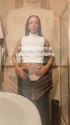 Healing from a proctocolectomy is tough… #ostomylife