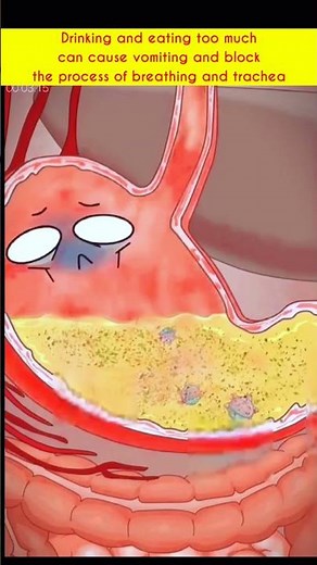 Drinking and eating too much can cause vomiting and block the process of breathing and trachea#asmr