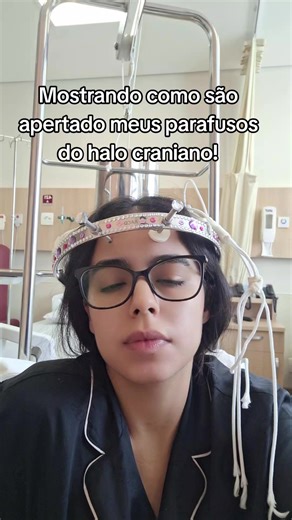 Aperto Parafusos Halo Craniano Pós Ganho de Peso