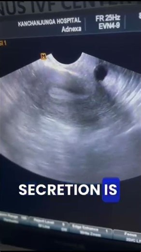 Nabothian Cyst in Cervix: Is It Serious? | Dr. Anupama Explains