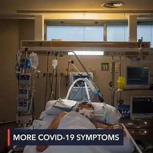 The list of coronavirus symptoms grows longer as time goes by. From flu-like symptoms such as chills, headaches, and fever, the last 3 months include a catalog of syndromes affecting almost all the body's organs, from the brain to the kidneys. Full story: https://www.rappler.com/science-nature/life-health/260282-pandemic-deepens-coronavirus-symptoms-multiply | Rappler