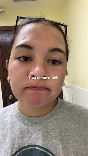 #areyouangela? #fyp #abcxyz #trending #rabbit