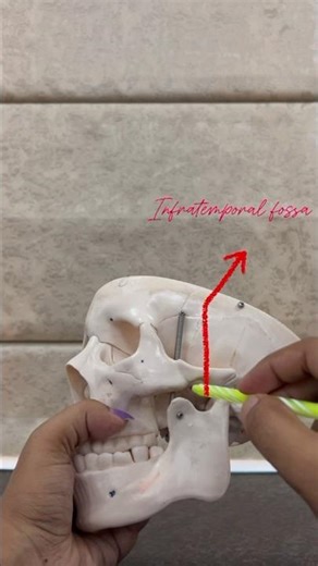 Infratemporal fossa /anatomy /temporal and infratemporal regions
