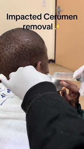 Effective Cerumen Removal Techniques for Clean Ears