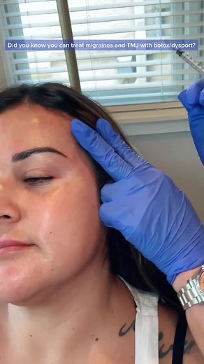 Did you know botox and dysport can be used not only for aesthetic treatments but also for migraines, TMJ, trapezius, neck and back pain? #fyp #botox #dysport #injection #injectables #migraines #migrainerelief #tmj #tmjtreatment #backpain #neckpain #neckpainrelief #nurse #nurseinjector #aestheticnurse