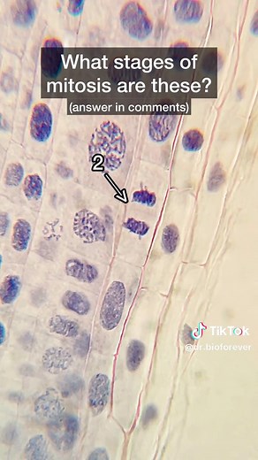 Challenge: Can you guess what cell division stages are shown in the final part of the video? . Let me know in the comments what mitosis stages you think 1, 2, and 3 are at the end of the video. . For this video I used a Leica ZOOM 200 stereoscope and an Olympus CX31 microscope at up to 400X magnification. #microscopy #microscope #biology #plantbiology #cellbiology #biologyclass #chromosomes #mitosis #celldivision #onion #drbioforever