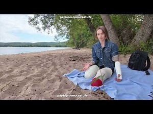 Girl double leg amputee, arm cast, she rest on the beach, lying in bed and first wheelchair ride
