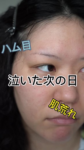 涙で目のむくみを効果的に解消する方法