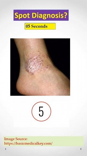 Dermatology Spot Diagnosis Quiz #45. Doctors, check your Clinical Skill