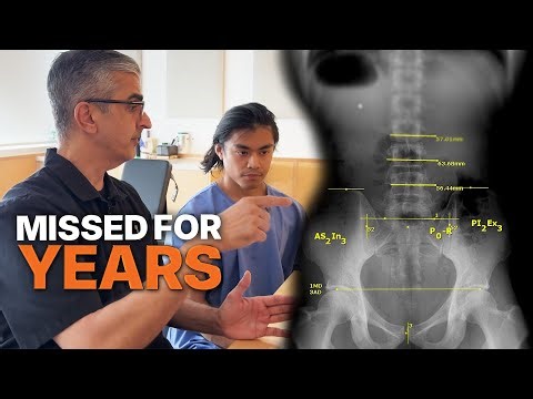 Powerlifter With Chronic Pain… The REAL Problem Was Hidden