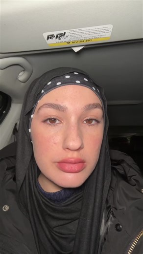 Exploring Unique Brown Eye Stripe Discovery