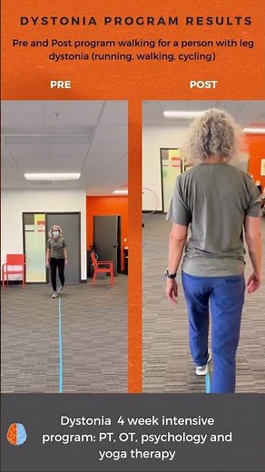 4 week dystonia intensive program outcomes