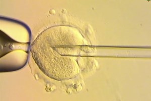 Healthy babies born in Britain after scientists used DNA from three people to avoid genetic disease