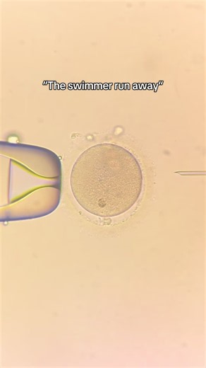 IVF & ICSI: A Closer Look at Embryology