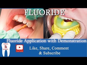 TOOTH FLUORIDATION PROGRAM - Fluoride application with demonstration