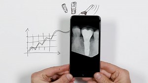 Connect to the future – Digital implant workflow by Dentsply Sirona - Prime innovation and smart digital workflows - EAO