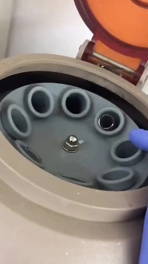 Urinalysis ❣️ #lablife #MedicalLabTechnician #microbiology | Lab life