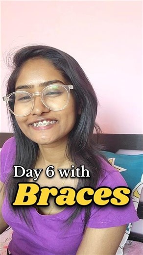Day 6 Braces Journey 😬 | Most Annoying Thing About Braces