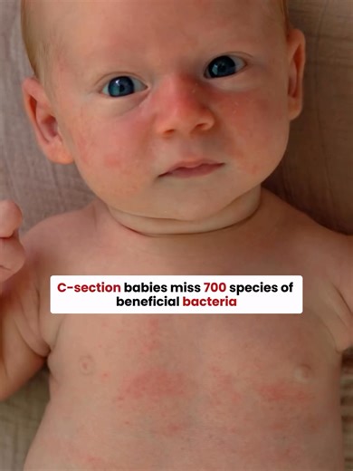 C-section baby? The microbiome can be rebuilt. Research shows surgical birth affects gut colonization. But the gut is resilient — especially in the first two years. Here's how to support it. the guide is in my bio 🤍 . . . #csectionbaby #babymicrobiome #guthealth #momtok #surgicalbirth