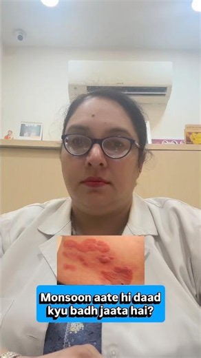 Monsoon Me Daad (Ringworm) Se Kaise Bachein? | Dermatologist Advice #parisaskinclinic #redness