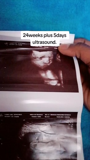 Sibongile Simelane on TikTok