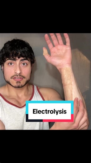 Electrolysis for Bottom Surgery Preparation