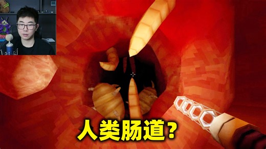 今年最逆天的游戏，肛肠科医生进入病人的肠道