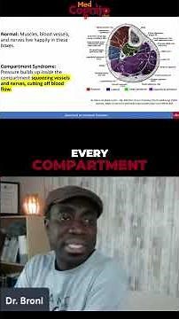 Compartment Syndrome: Causes, Symptoms & Treatments Explained! #shorts