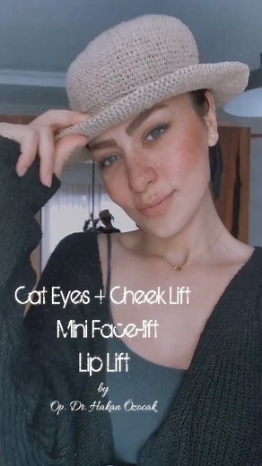 Hakan Özocak on Instagram: "Cat Eyes + Cheek Lift + Mini Face-Lift + Lip Lift. Post-operative 2 months results. #plasticsurgery #aestheticsurgery #facelift #facelifting #cateyes #cateyesurgery #foxeyes #almondeyes #browlift #minifacelift #temporallift #cheeklift #liftingfacial #liplift #chirurgiaplastica #chirurgiaestetica #cirugiaplastica #cirugiaestetica #plastischechirurgie #chirurgieesthetique #liftingvisage #threadlift #estetikcerrahi #plastikcerrahi"