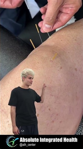 "I support this!" 🙌 If knee pain’s been slowing you down, it’s time to try something that w #shorts