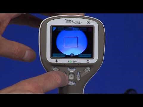 Volk Pictor - Setup For Retinal Imaging