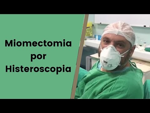 Miomectomia por Histeroscopia