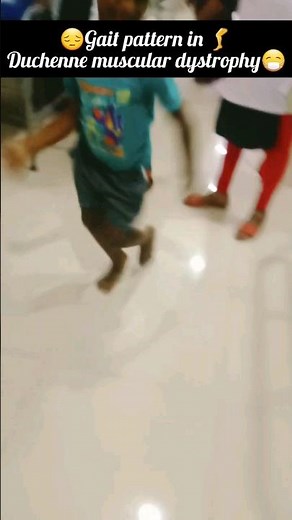 😔Gait pattern in 🦵Duchenne muscular dystrophy😷