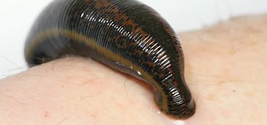 WATCH: See How Leeches Can Be A Surgeon's Sidekick - WOUB Public Media