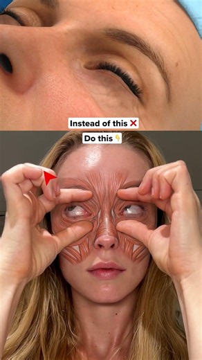 Do This to Reduce Puffy Eyes