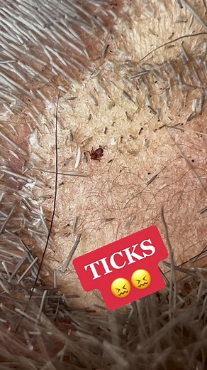 I found the ticks @mrs.uncle 😖 #nativetiktok #indigenous #moosehidetanning #urbanhidetanning #moosehide #ticks