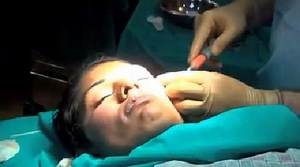 Non-Surgical Face Lift: Watch It Happen Step by Step