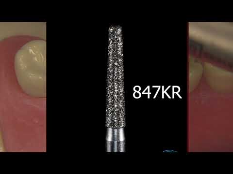 CERAMIC ONLAY #18, Columbia Tooth | Preparing an MOD Ceramic Onlay on Tooth